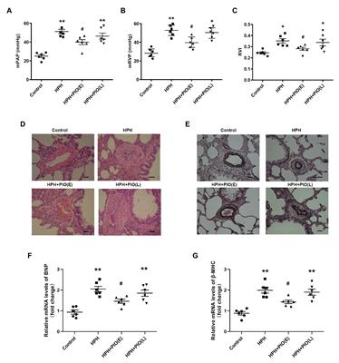 Tribbles Homolog 3-Mediated Vascular Insulin Resistance Contributes to Hypoxic Pulmonary Hypertension in Intermittent Hypoxia Rat Model